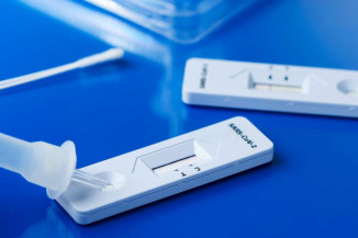 OPAS recomenda que pessoas com sintomas tenham prioridade para testes
