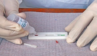 Saúde registra 2,6 mil casos e 16 novos óbitos por Covid em MS