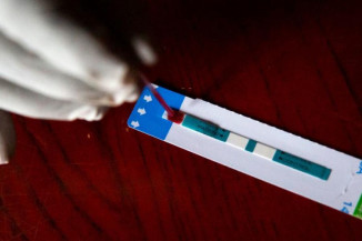 Nova variante de HIV mostra a urgência de acabar com a pandemia de AIDS