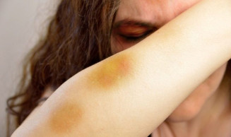 Lei destina 5% de fundo de segurança pública ao enfrentamento da violência contra a mulher