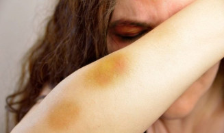 Comissão aprova justa causa em demissão por violência contra mulher