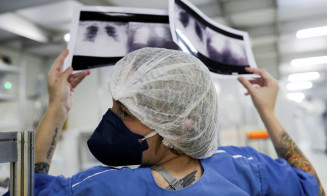 Mães são maioria entre cuidadoras de pacientes com doenças raras