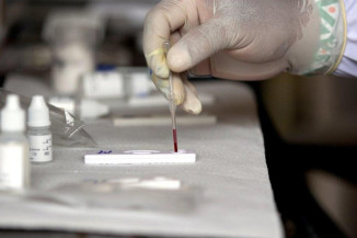 OPAS publica novas orientações sobre hepatite infantil desconhecida