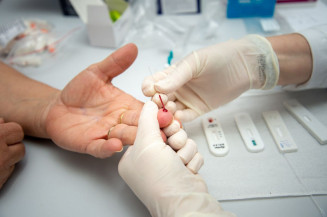 Em ação do Julho Amarelo, 10 pessoas testam positivo para HIV em Dourados