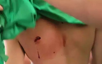 Durante briga em escola, estudante é ferido com canivete
