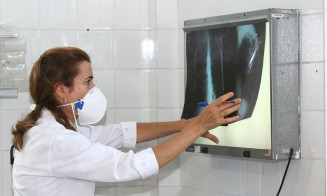 OMS: 1,6 milhão de pessoas morreu por tuberculose no mundo em 2021