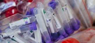 Aumento de casos de COVID-19, influenza e VSR são tripla ameaça