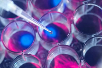 HIV: 5º paciente é curado após transplante de células-tronco