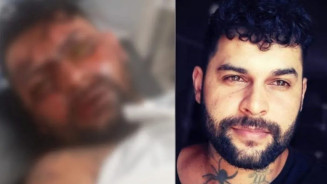 Mulher joga soda cáustica no rosto do ex e deixa ele cego