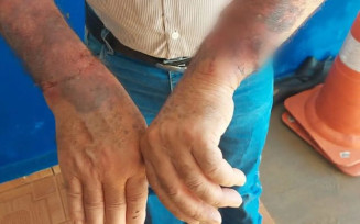 Taxista é torturado e algemado em árvore na fronteira
