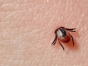 MS tem cinco casos suspeitos de febre maculosa