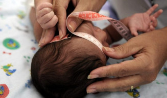 Comissão aprova indenização e pensão especial às pessoas com complicações do Zika vírus