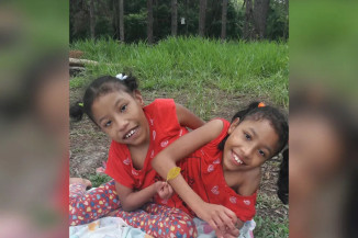 Gêmeas siamesas de 13 anos falam sobre rotina e possível 'separação': 'Somos felizes assim'