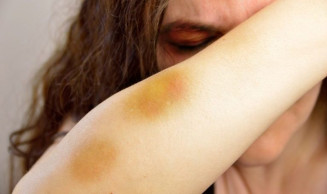 Comissão aprova projeto que cria auxílio para mulher afastada do trabalho por violência doméstica