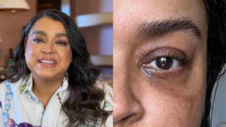 Preta Gil anuncia que está livre de câncer após cirurgia para retirada de tumor