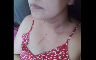 Homem é preso acusado de agredir a irmã vereadora