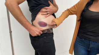 Jornalista canadense e cineasta denunciam agressões e roubos em área de conflito