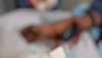 Cilindro de ar-condicionado estoura e homem tem braço dilacerado