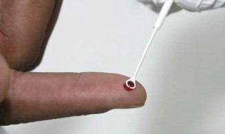 Saúde busca parcerias para expandir distribuição de medicamentos de prevenção ao HIV