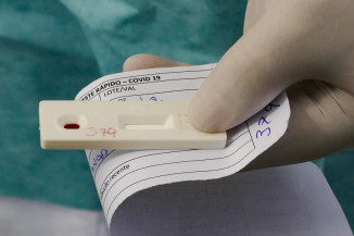 MS registra três novas mortes e 263 casos de Covid-19