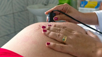 Saúde recomenda cálcio para todas as gestantes para prevenir eclâmpsia