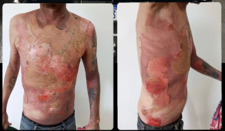 Homem de 31 anos, morador de uma edícula no mesmo lote que a investigada (Foto: Divulgação/PC)