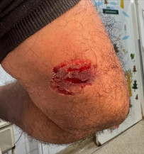 Paciente aguardava transferência quando mordeu profissional da saúde - Foto: Divulgação