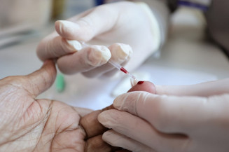 Centro de Testagem e Aconselhamento em Dourados possui especialistas para fazer diagnóstico e propor tratamento adequado a doenças virais. Foto: A. Frota