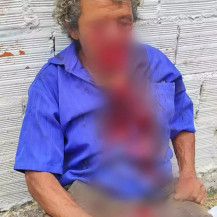 Vítima teve rosto dilacerado ao ser atacado por pitbull. (Foto: Reprodução/Polícia Civil)