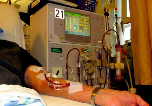 Pessoas com doença renal crônica passam a ter status de PCD em MS