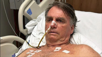 Bolsonaro passa por novo procedimento para tratar soluços persistentes