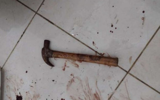 Mulher é atacada pelo companheiro e transferida em estado grave após agressão em Maracaju