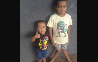Irmãos de Amambai enfrentam deformidade grave e aguardam cirurgia há anos
