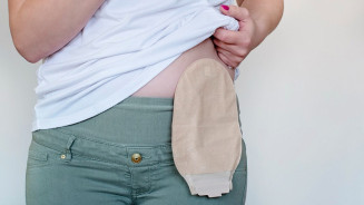 Grupo gratuito oferece apoio a pessoas ostomizadas em Dourados